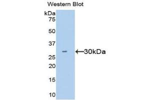 Western blot analysis of the recombinant protein. (HGF anticorps  (AA 495-728))