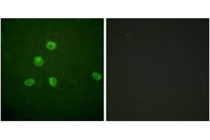 Immunofluorescence (IF) image for anti-FBJ Murine Osteosarcoma Viral Oncogene Homolog B (FOSB) (AA 12-61) antibody (ABIN2888837) (FOSB anticorps  (AA 12-61))