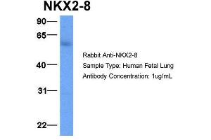 Host:  Rabbit  Target Name:  NKX2-8  Sample Type:  Human Fetal Lung  Antibody Dilution:  1. (NKX2-8 anticorps  (C-Term))