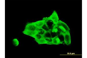 Immunofluorescence of monoclonal antibody to DSC3 on A-431 cell.