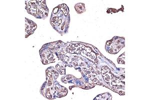 Immunohistochemistry of paraffin-embedded human placenta using PD-L1/CD274 Rabbit pAb (ABIN6129976, ABIN6138153, ABIN6138154 and ABIN6215142) at dilution of 1:100 (40x lens). (PD-L1 anticorps  (AA 19-238))
