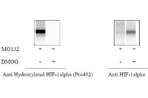HeLa cells were treated or untreated with MG132 and DMOG. (Hydroxylated HIF-1 alpha (P402) Kit ELISA)