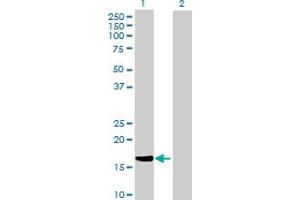 Western Blot analysis of HSPB7 expression in transfected 293T cell line by HSPB7 MaxPab polyclonal antibody. (HSPB7 anticorps  (AA 1-170))