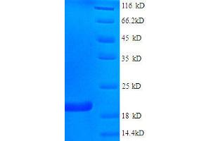 Fragile Histidine Triad (FHIT) (AA 2-147), (full length) protein (His tag)