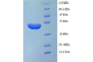 SDS-PAGE (SDS) image for Interleukin 1 alpha (IL1A) (AA 113-271) protein (His-SUMO Tag) (ABIN5709737)