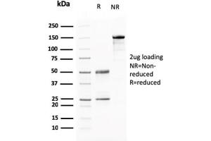 SDS-PAGE Analysis Purified AKT1 Mouse Monoclonal Antibody (AKT1/2784). (BARX1 anticorps)