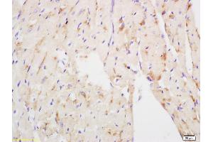 Formalin-fixed and paraffin embedded mouse heart labeled with Anti NDUFS3 Polyclonal Antibody, Unconjugated (ABIN750673) at 1:200 followed by conjugation to the secondary antibody and DAB staining