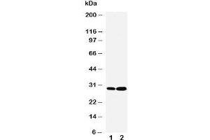 Western blot testing of LASP1 antibody and Lane 1:  HeLa;  2: MCF-7 cell lysate. (LASP1 anticorps  (C-Term))