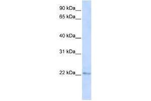 C6ORF64 antibody used at 1 ug/ml to detect target protein. (SAYSD1 anticorps  (C-Term))