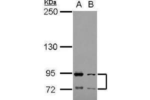 WB Image Sample (30 ug of whole cell lysate) A: Raji B: K562 5% SDS PAGE antibody diluted at 1:1000 (FCAR anticorps)