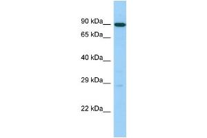 Host: Rabbit Target Name: UTP14C Sample Type: 721_B Whole Cell lysates Antibody Dilution: 1. (UTP14C anticorps  (C-Term))