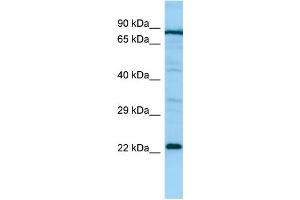 WB Suggested Anti-PTGES2 Antibody Titration: 1. (PTGES2 anticorps  (Middle Region))