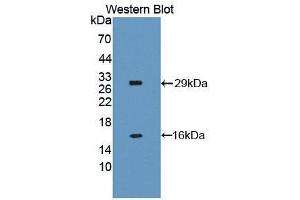 Western blot analysis of the recombinant protein. (NAIP anticorps  (AA 500-759))