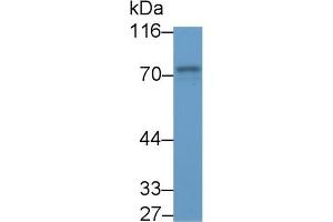 Detection of SYK in Porcine Spleen lysate using Polyclonal Antibody to Spleen Tyrosine Kinase (SYK)