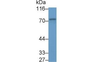 Detection of SYK in Porcine Spleen lysate using Polyclonal Antibody to Spleen Tyrosine Kinase (SYK) (SYK anticorps  (AA 374-635))