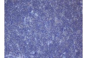 Image no. 3 for anti-DEAD (Asp-Glu-Ala-Asp) Box Polypeptide 59 (DDX59) (AA 1-303) antibody (ABIN1490728) (DDX59 anticorps  (AA 1-303))