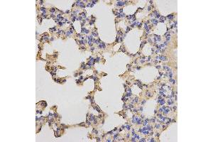 Immunohistochemistry of paraffin-embedded mouse lung using PRKACB antibody. (PRKACB anticorps  (AA 1-351))