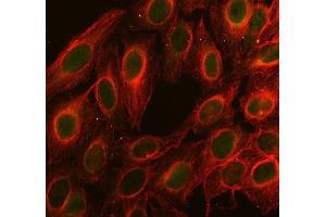 IF analysis of Cdc25C using anti-Cdc25C antibody (ABIN3042352) and anti-Tubulin Alpha antibody (ABIN7600339). (CDC25C anticorps  (AA 175-473))