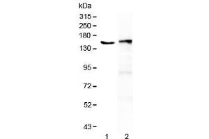 Western blot testing of 1) human placenta and 2) mouse spleen lysate with PLCG2 antibody at 0. (Phospholipase C gamma 2 anticorps)