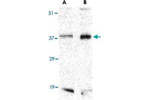 Western blot analysis of BAG1 in PC-3 cell lysate with BAG1 polyclonal antibody  at (A) 1 and (B) 2 ug/mL . (BAG1 anticorps  (C-Term))