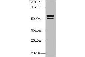 Western blot All lanes: KRT72 antibody at 2 μg/mL + MCF-7 whole cell lysate Secondary Goat polyclonal to rabbit IgG at 1/10000 dilution Predicted band size: 56, 52 kDa Observed band size: 56, 52 kDa (Keratin 72 anticorps  (AA 301-511))