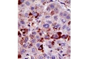 Image no. 2 for anti-Small Ubiquitin Related Modifier Protein 1 (SUMO1) antibody (ABIN356808) (SUMO1 anticorps)