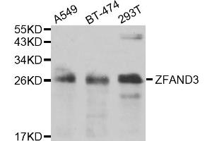 Western blot analysis of extracts of various cell lines, using ZFAND3 antibody (ABIN5975562) at 1/1000 dilution. (ZFAND3 anticorps)