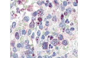 IHC analysis of FFPE human spleen tissue stained with anti-SNAIL antibody (SNAIL anticorps  (AA 9-39))
