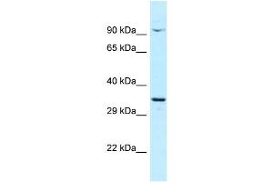 Host: Rabbit Target Name: CTNNBL1 Sample Type: OVCAR-3 Whole Cell lysates Antibody Dilution: 1. (CTNNBL1 anticorps  (C-Term))