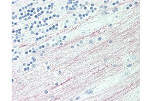 Anti-CPT1C antibody IHC staining of human brain, cerebellum, white matter.