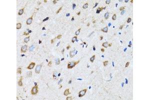 Immunohistochemistry of paraffin-embedded Rat brain using NDE1 Polyclonal Antibody at dilution of 1:100 (40x lens). (NDE1 anticorps)