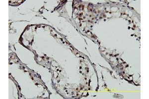 Immunoperoxidase of monoclonal antibody to GTF2H1 on formalin-fixed paraffin-embedded human testis tissue.