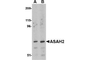 Western Blotting (WB) image for anti-N-Acylsphingosine Amidohydrolase (Non-Lysosomal Ceramidase) 2 (ASAH2) (C-Term) antibody (ABIN1030258) (ASAH2 anticorps  (C-Term))