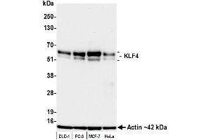 Western Blotting (WB) image for anti-Kruppel-Like Factor 4 (Gut) (KLF4) (AA 75-125) antibody (ABIN7795639) (Recombinant KLF4 anticorps  (AA 75-125))