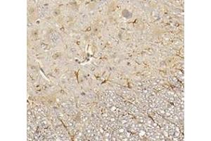 Immunohistochemistry analysis of paraffin-embedded mouse spinal cord using,CHERP (ABIN7073277) at dilution of 1: 3600