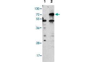 Western blot analysis of CPT1B (arrow) using rabbit CPT1B polyclonal antibody . (CPT1B anticorps  (C-Term))