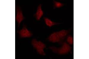 ABIN6275479 staining NIH-3T3 by IF/ICC. (RGS12 anticorps  (N-Term))
