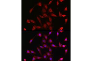 Immunofluorescence analysis of NIH/3T3 cells using Glucocorticoid Receptor Rabbit pAb (ABIN3023090, ABIN3023091, ABIN3023092, ABIN1513281 and ABIN6219384) at dilution of 1:200 (40x lens).