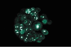 Immunofluorescence staining of WiDr cells (Human colorectal adenocarcinoma, ATCC CCL-218). (RAD23B anticorps  (AA 73-193))
