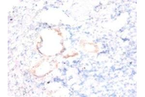 Immunohistochemistry of paraffin-embedded human kidney tissue using ABIN7143861 at dilution of 1:50 (Ensa anticorps  (AA 1-121))