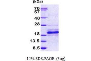 SDS-PAGE (SDS) image for DnaJ (Hsp40) Homolog, Subfamily C, Member 24 (DNAJC24) (AA 1-149) protein (His tag) (ABIN5852986) (DNAJC24 Protein (AA 1-149) (His tag))