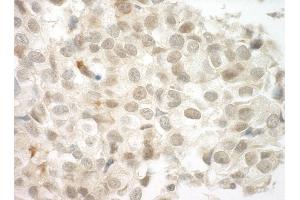 Immunohistochemistry (IHC) image for anti-Papillary Renal Cell Carcinoma (Translocation-Associated) (PRCC) (AA 125-175) antibody (ABIN7448740)
