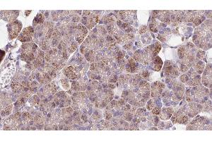 ABIN6273272 at 1/100 staining Human pancreas cancer tissue by IHC-P. (NCKAP1 anticorps  (Internal Region))