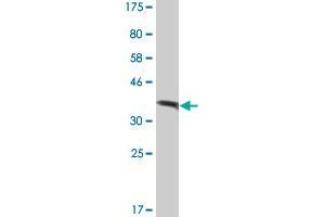 Western Blot detection against Immunogen (37.