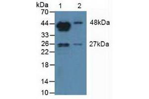 Western blot analysis of (1) Mouse Testis Tissue and (2) Mouse Placenta Tissue. (Aromatase anticorps  (AA 196-373))
