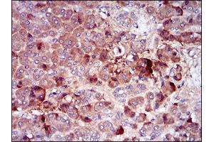 Immunohistochemical analysis of paraffin-embedded pancreas tissues using CSF1R mouse mAb with DAB staining. (CSF1R anticorps  (AA 344-497))