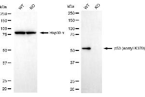 Western blotting analysis using p53 (acetyl K370) antibody (ABIN7800682). (Recombinant p53 anticorps  (acLys370))