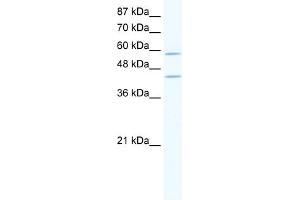 WB Suggested Anti-DCP1A Antibody Titration:  2. (DCP1A anticorps  (N-Term))