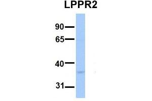Host:  Rabbit  Target Name:  LPPR2  Sample Type:  Human Fetal Brain  Antibody Dilution:  1. (LPPR2 anticorps  (Middle Region))