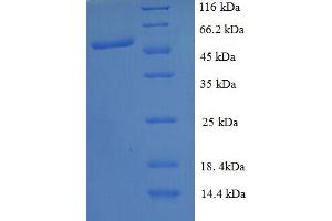 SDS-PAGE (SDS) image for Protein Interacting With Protein Kinase C, alpha 1 (PICK1) (AA 1-200), (partial) protein (GST tag) (ABIN5712409)